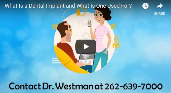dental implants explained video 5c54d827e5616