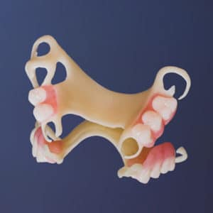 5 ways dentures can help with sleep apnea 5c9a4ac07dd7e