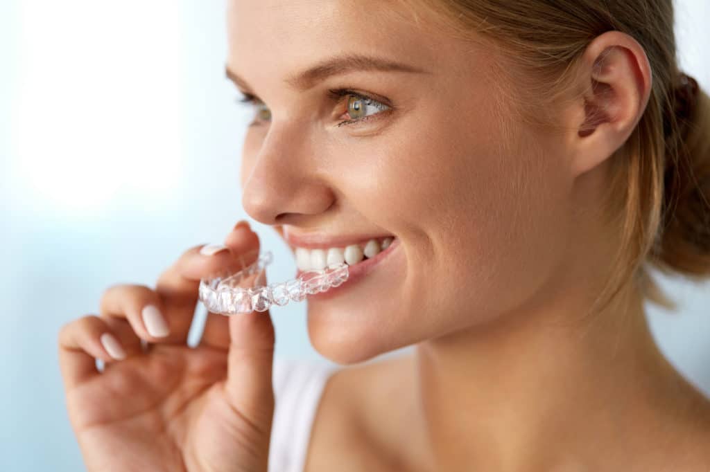 orthodontic braces your ticket to a healthy and beautiful smile 5c9930ae4cea9