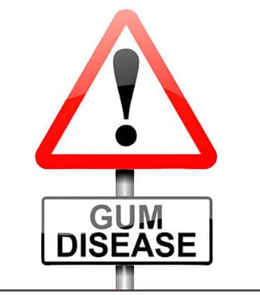 caution gum disease1 e1553200750777